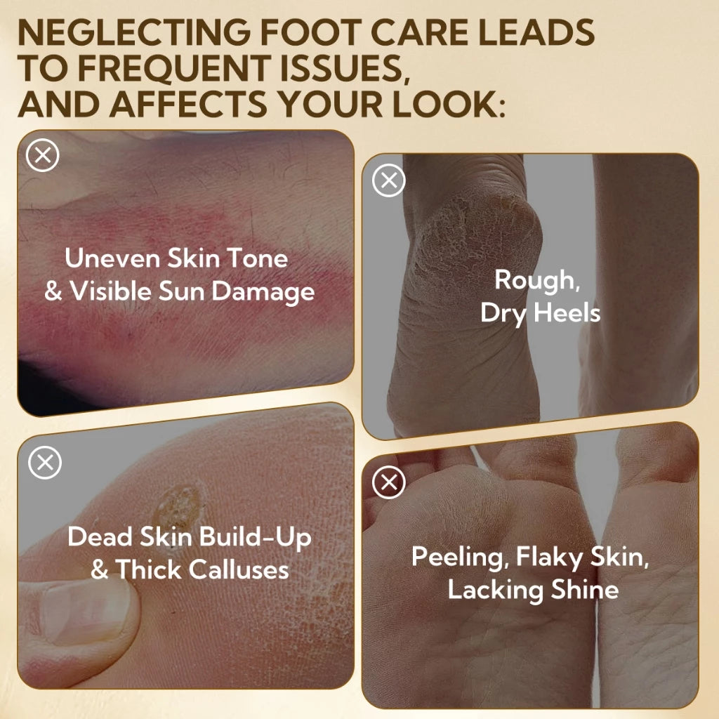 Baby soft feet result after using exfoliating foot mask