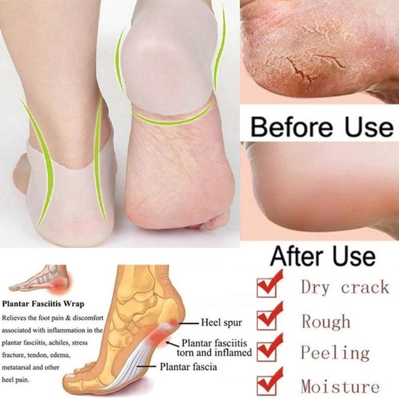 Close-up of silicone gel lining for moisturizing cracked heels